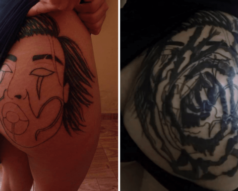 Tatuagem de jovem dá errado