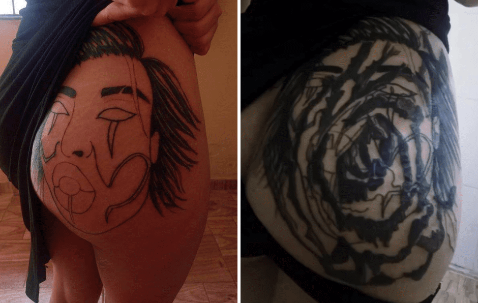 Tatuagem de jovem dá errado